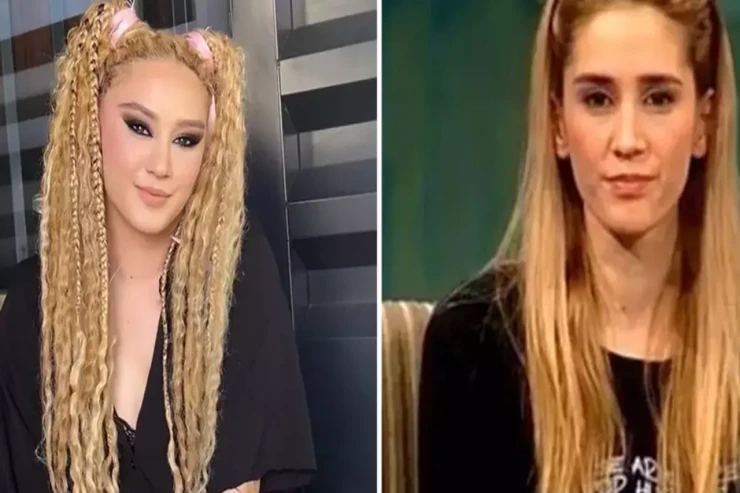 Məşhur aktrisa tanınmaz halda  - Danışdıqları ilə şok etdi