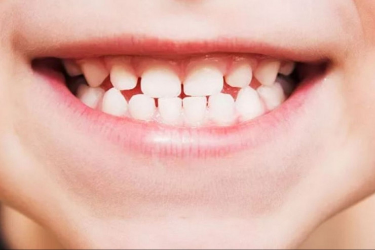 Yapon alimləri dişlərin yenidən böyüməsi üçün dərman hazırlayıb