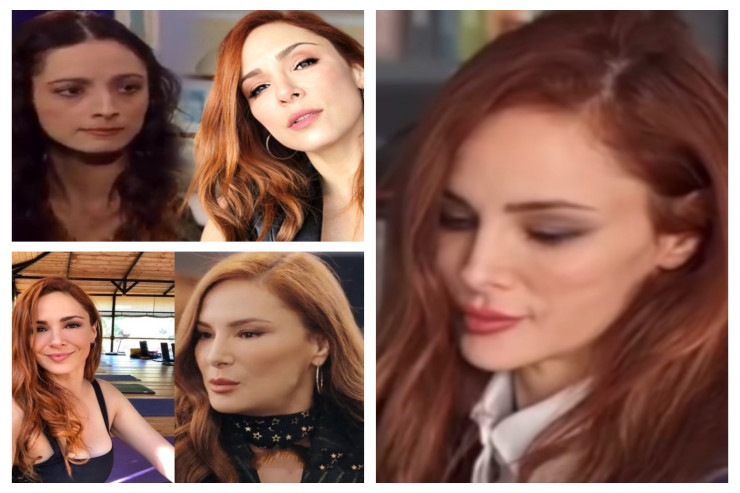 Məşhur aktrisanın estetik möcüzəsi  estetik faciəsinə   döndü - İDDİA