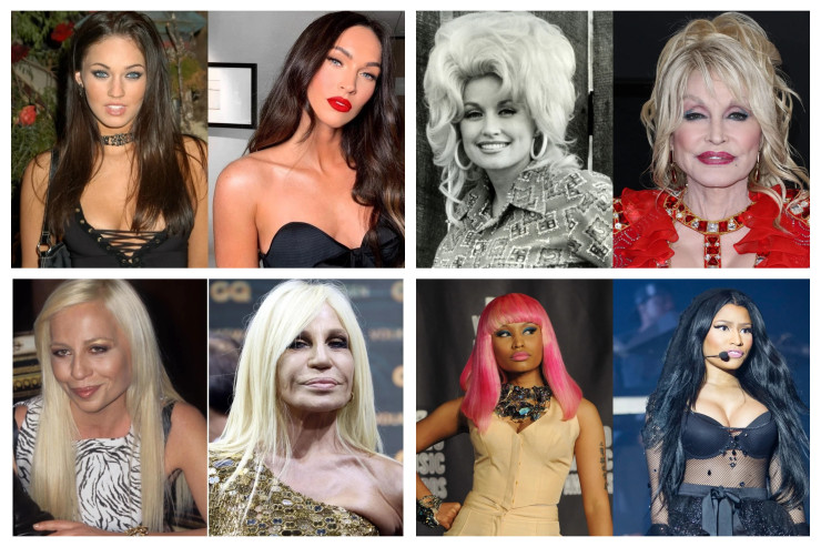 Ən çox plastik əməliyyat  etdirmiş ulduzlar