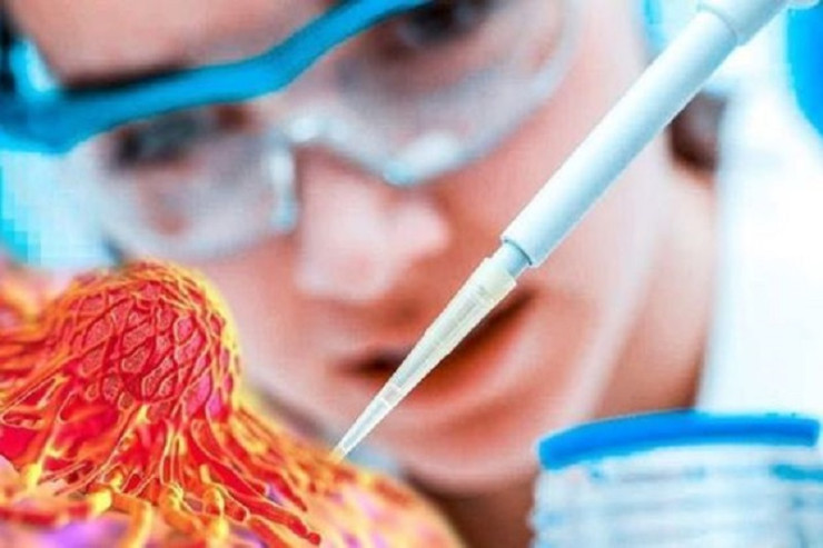 Azərbaycanlı həkim xərçəngin əlacını  tapdı - VİDEO 