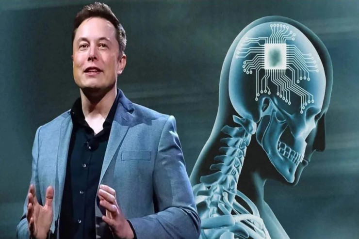 İlon Mask 2026-cı ilə qədər 1000 nəfərə çip taxacaq 