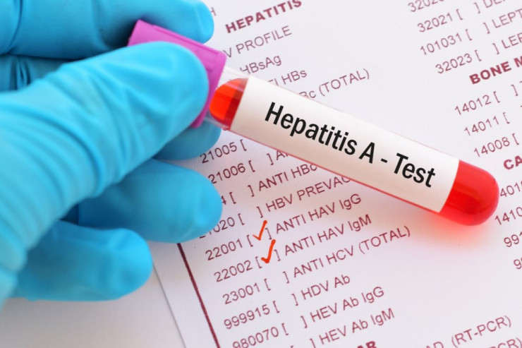 Hepatit viruslarından necə qorunmaq lazımdır? - MÜSAHİBƏ 