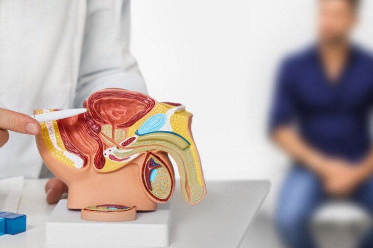 Kişilərə prostatın inkişafının  əsas səbəbi   izah edildi