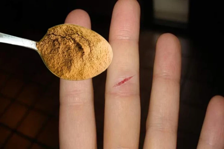 Yaranın üzərinə bir az tökün, MÖCÜZƏNİ GÖRÜN 