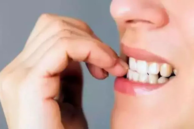 Dırnaq yeməyi  dayandırmaq üçün   4 sadə üsul