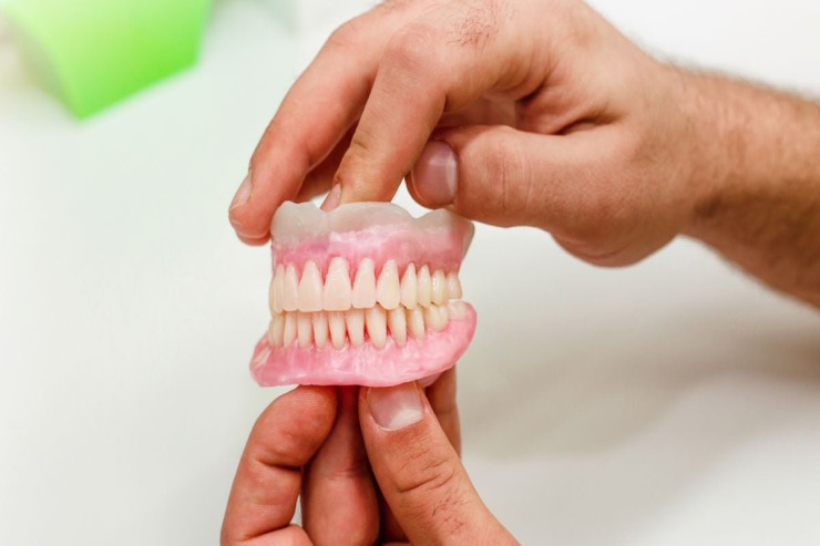 Sidikdən  diş implantları   yaradıldı: bu haqda nə məlumdur 