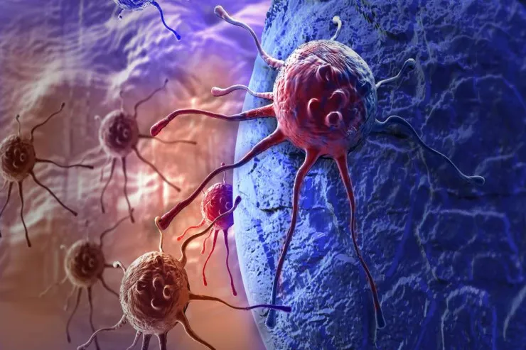 Yüksək karbohidratlı pəhriz ağciyər xərçəngi riskini   artıra bilər