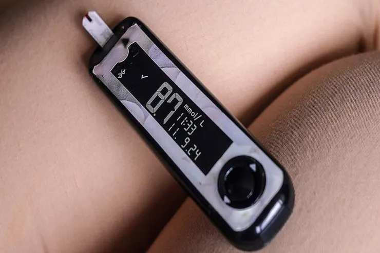 Diabet və dişlər arasında nə əlaqə var? - Alimlər açıqladı 