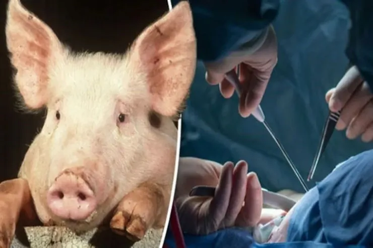 Azərbaycanda insana donuz böyrəyi də  köçürüləcək - Həkim DANIŞDI 