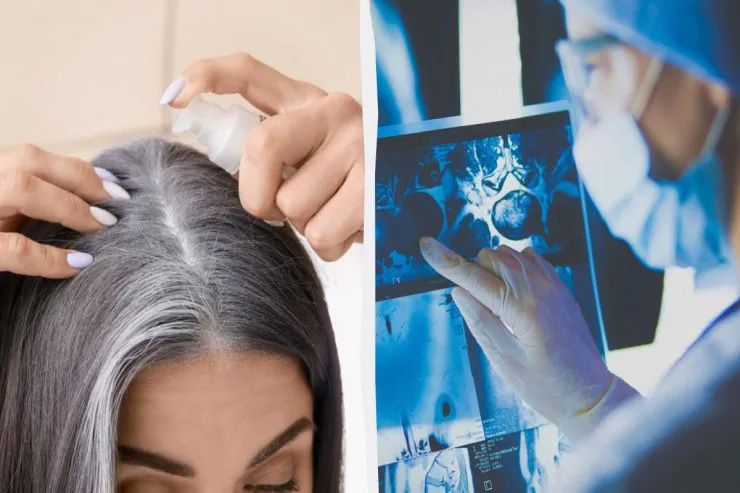 Ağ saçlara görə narahat olmayın:  Saçların qocalmasının gözlənilməz funksiyası  kəşf edildi