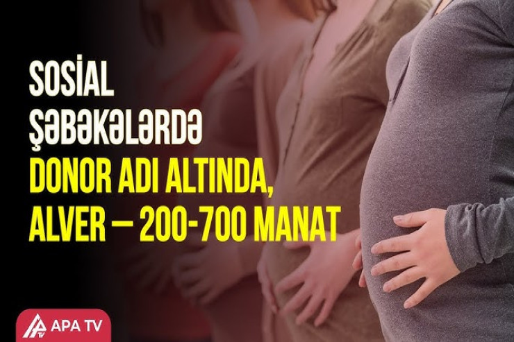 Follikul donorluğu Azərbaycanda hamını bir-birinə qohum edə bilər? – ARAŞDIRMA