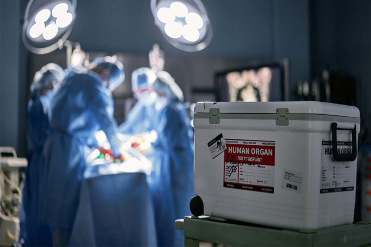 Donor az, orqana ehtiyacı olan çox - ARAŞDIRMA 