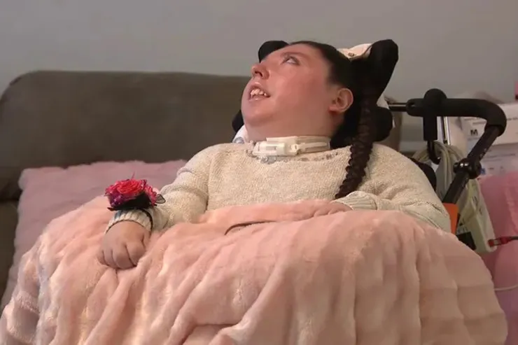 Beyinsiz doğulan  qız 20 yaşını qeyd edir - MÖCÜZƏ