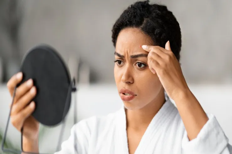 Həyatınızı məhv edən az bilinən dəri xəstəliyi 