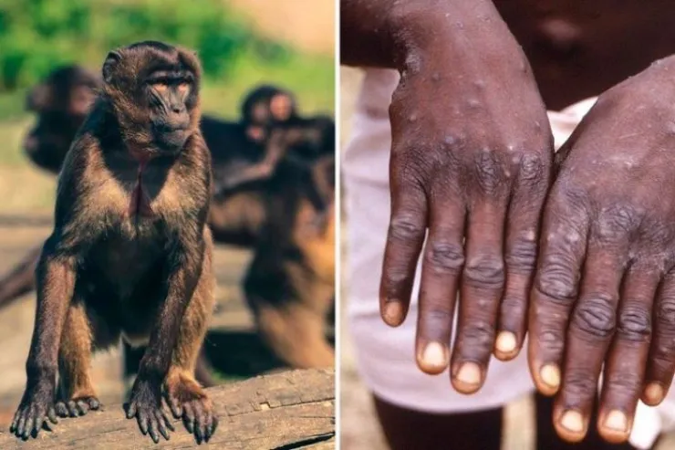 Mutasiyaya uğramış meymun çiçəyi  yayılır: ÜST-dən həyəcan təbili  