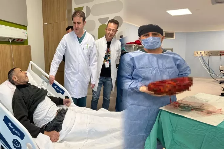 Tibb dünyasını şoka salan  əməliyyat: Qarnından 8 kiloluq  böyrək   çıxarıldı