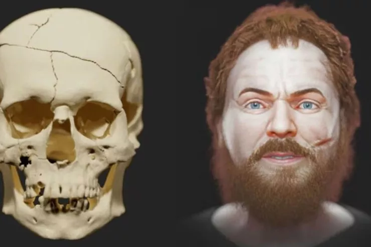 Həyatdakı əsl vampirin  sifəti belə olub