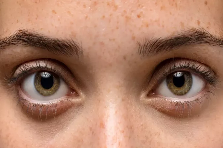 Özləri üçün danışan gözlər  - formalarını necə vurğulamaq  olar?