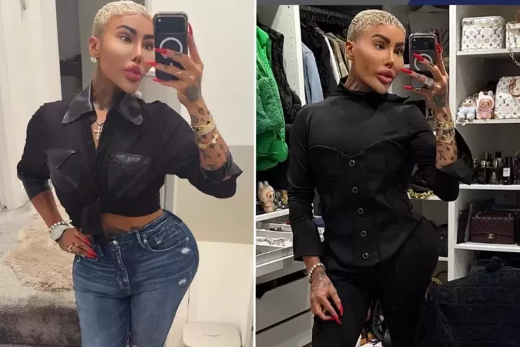 Kim Kardaşyana  bənzəmək üçün əməliyyat etdirən məşhur ÖLDÜ 