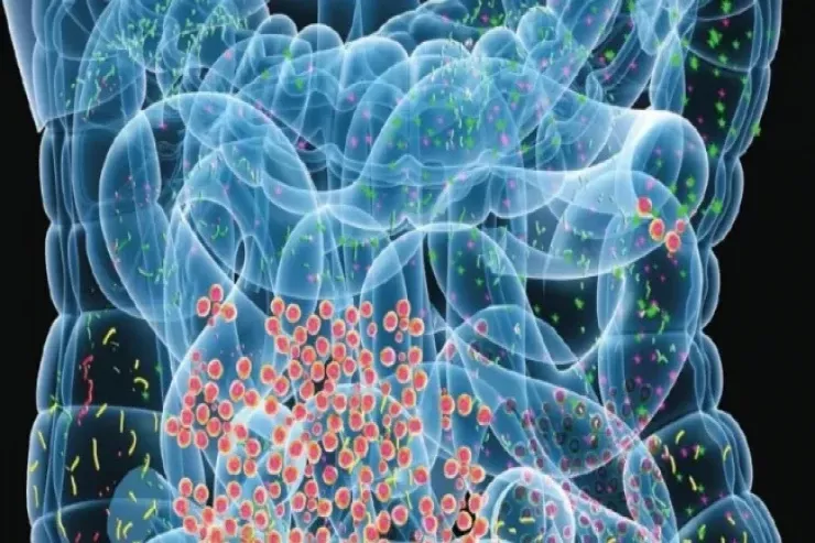 Kimyaterapiyanın bağırsaq bakteriyalarına gözlənilməz təsiri 