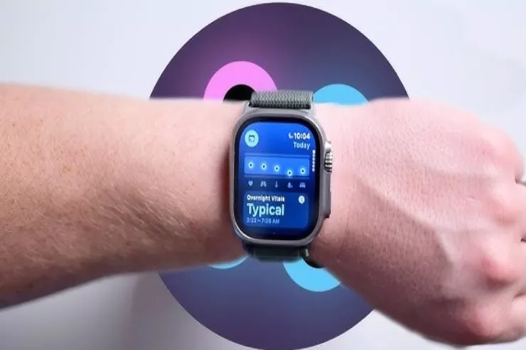 “Apple Watch” almağı planlaşdıranlara pis xəbər – Bu şeylər olmayacaq 
