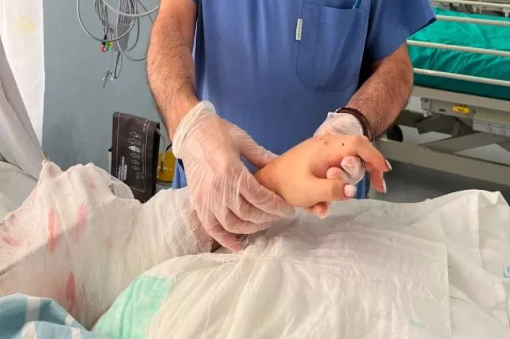 Bakıda qadının qopmuş qolu  yerinə bərpa olundu