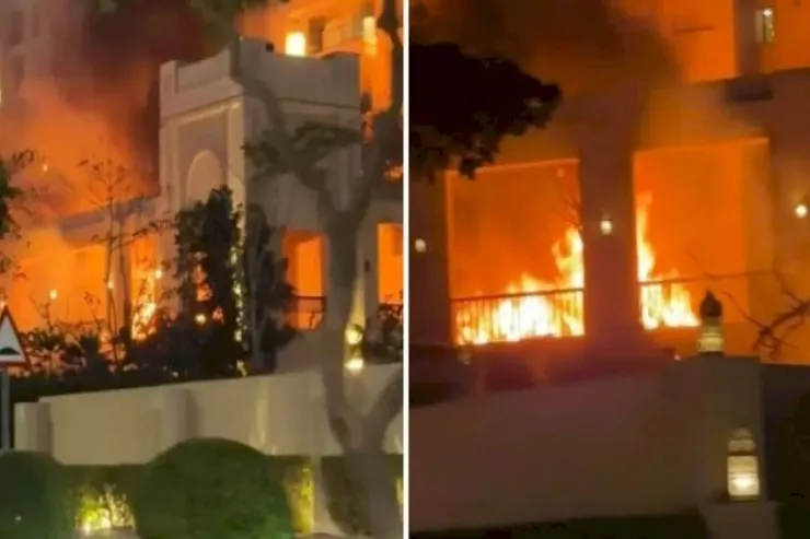 Dubayda yaralanan azərbaycanlıdan YENİ XƏBƏR 