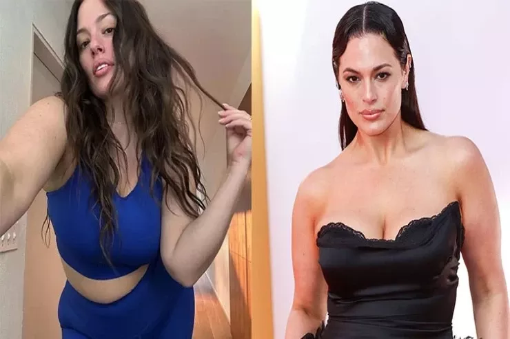 Məşhur model arıqlama iynələrindən NƏLƏR DANIŞDI  - “Elə bil üzümə sillə vuruldu”  -FOTOLENT 