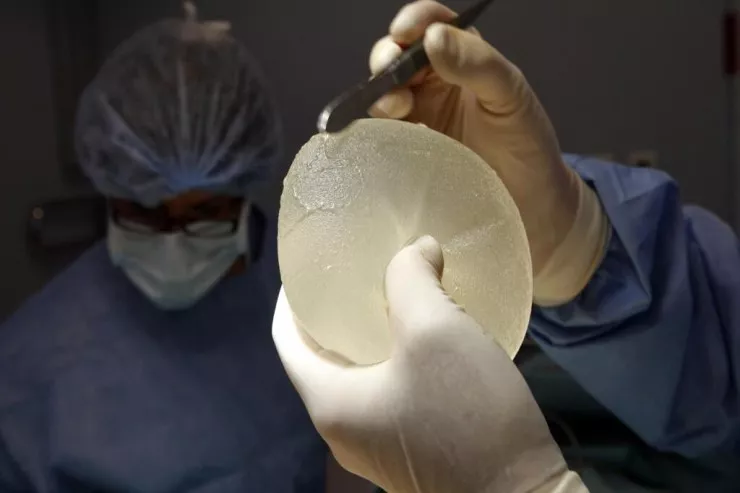Polis qadın  döş implantının   çıxarılmasından sonra öldü:  Faciənin  TƏFƏRRÜATLARI 