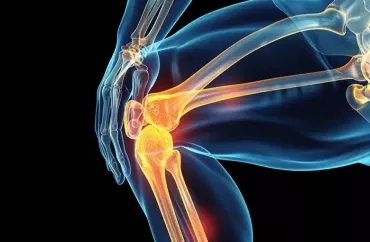Epilepsiya dərmanı oynaqların bərpasına kömək edə bilər