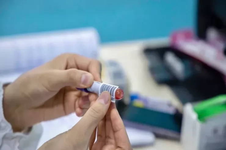Qonşu ölkədə meymunçiçəyi HƏYƏCANI:  5 nəfər xəstəxanaya yerləşdirildi