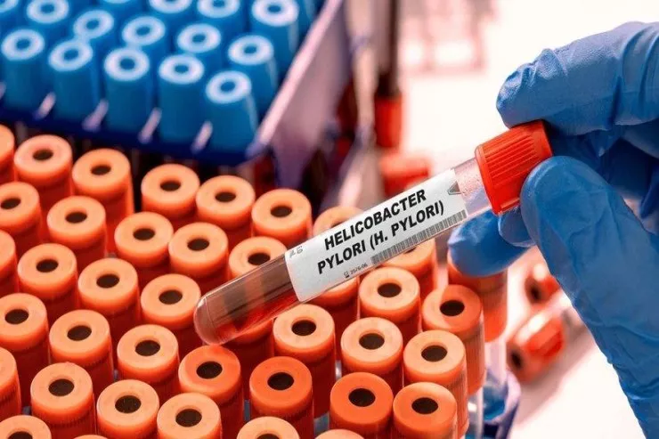 Hər il 2 milyondan çox yeni xərçəng halı beş infeksiya ilə əlaqəlidir - ARAŞDIRMA 